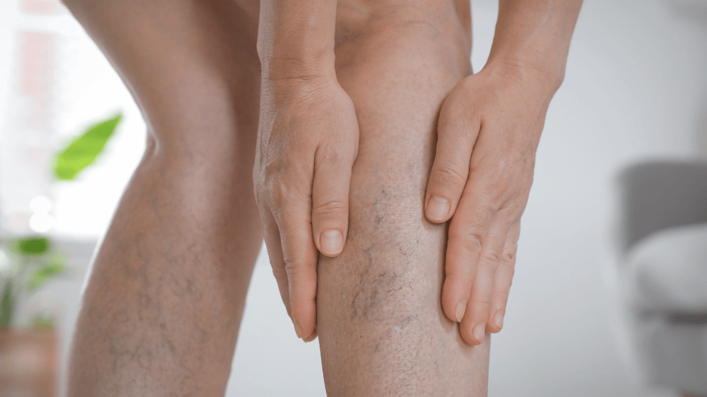 El Dr. Antonio Jiménez Ramos explica cómo mejorar el drenaje venoso en las piernas